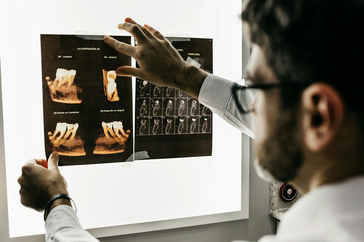 Panorama-Röntgenaufnahme der Zähne